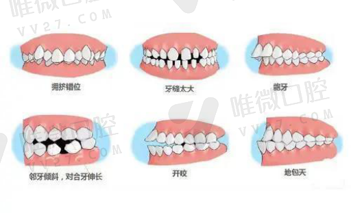 对牙医的评价的*典语录（赞美牙科医生的*典语录）(图1)